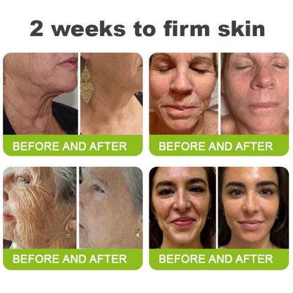 Add Hyaluronic Acid Serum — Save 30% Today