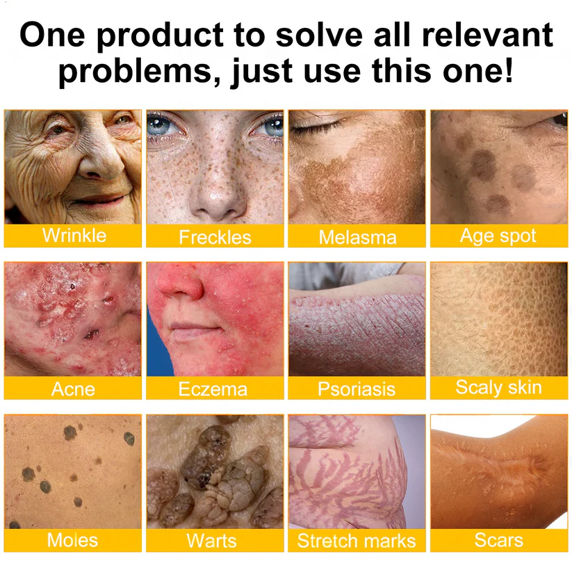 🌟💛 Rolimey® Bee venom Pro Comprehensive Cream —Tightening for Skin Types 🔥