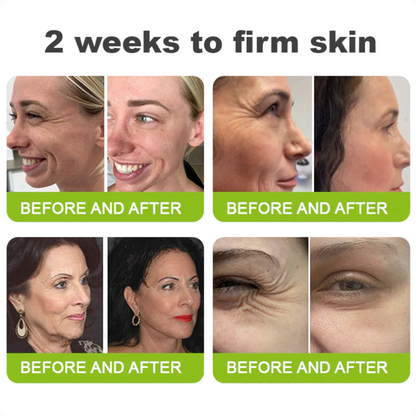 Add Hyaluronic Acid Serum — Save 30% Today