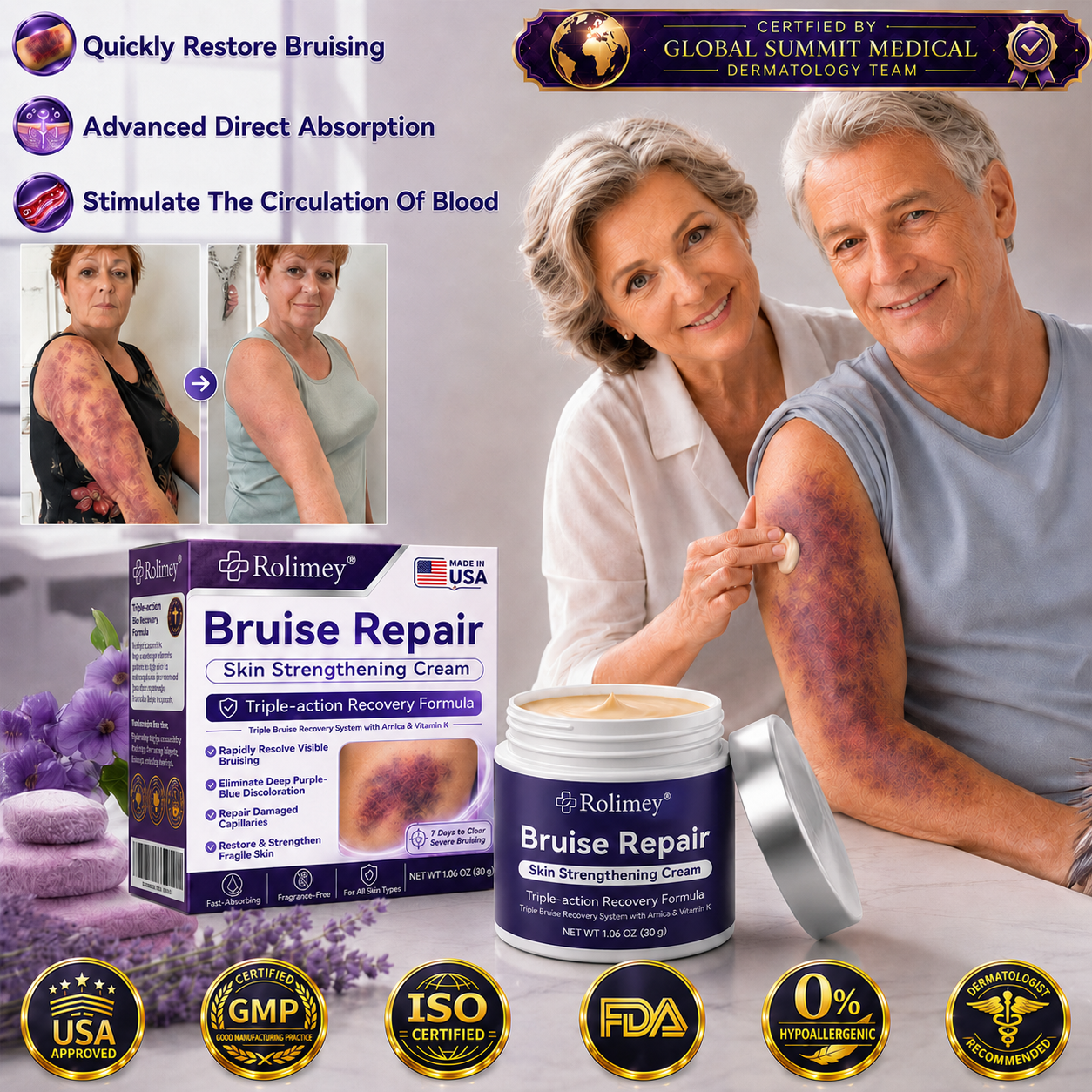 👨‍⚕️Over 100,000 units sold💕 - Rolimey® cream to repair bruises and strengthen the skin