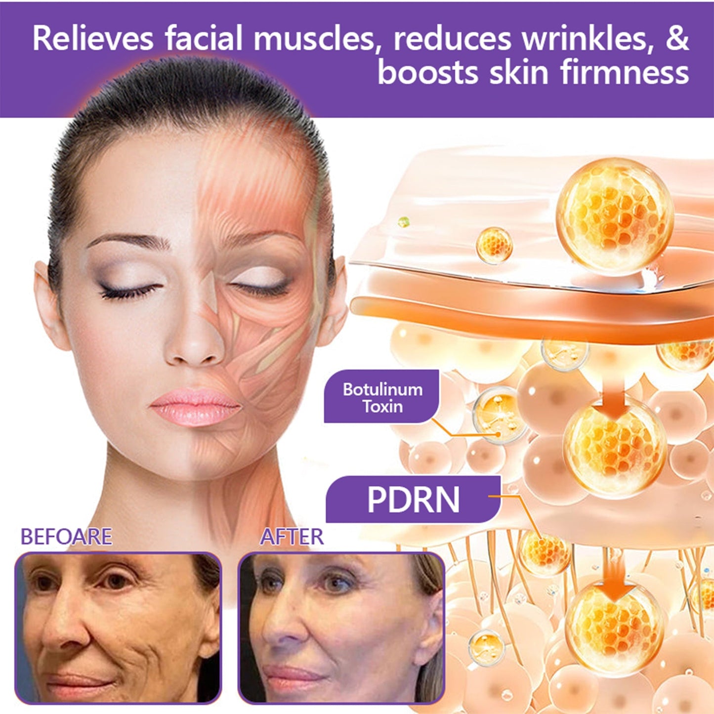🔥🔥 Improved Version with New Packaging 2026丨⚡️ROLIMEY® PDRN Multi-Peptide Roll-On Body Cream for Firming, Regenerating & Smoothing Skin