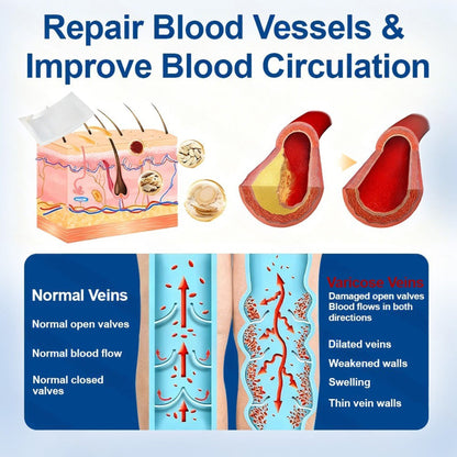 👨‍⚕️GFOUK® VeinEase Microneedle Care Patch⚡Instant Relief, Long-Term Results