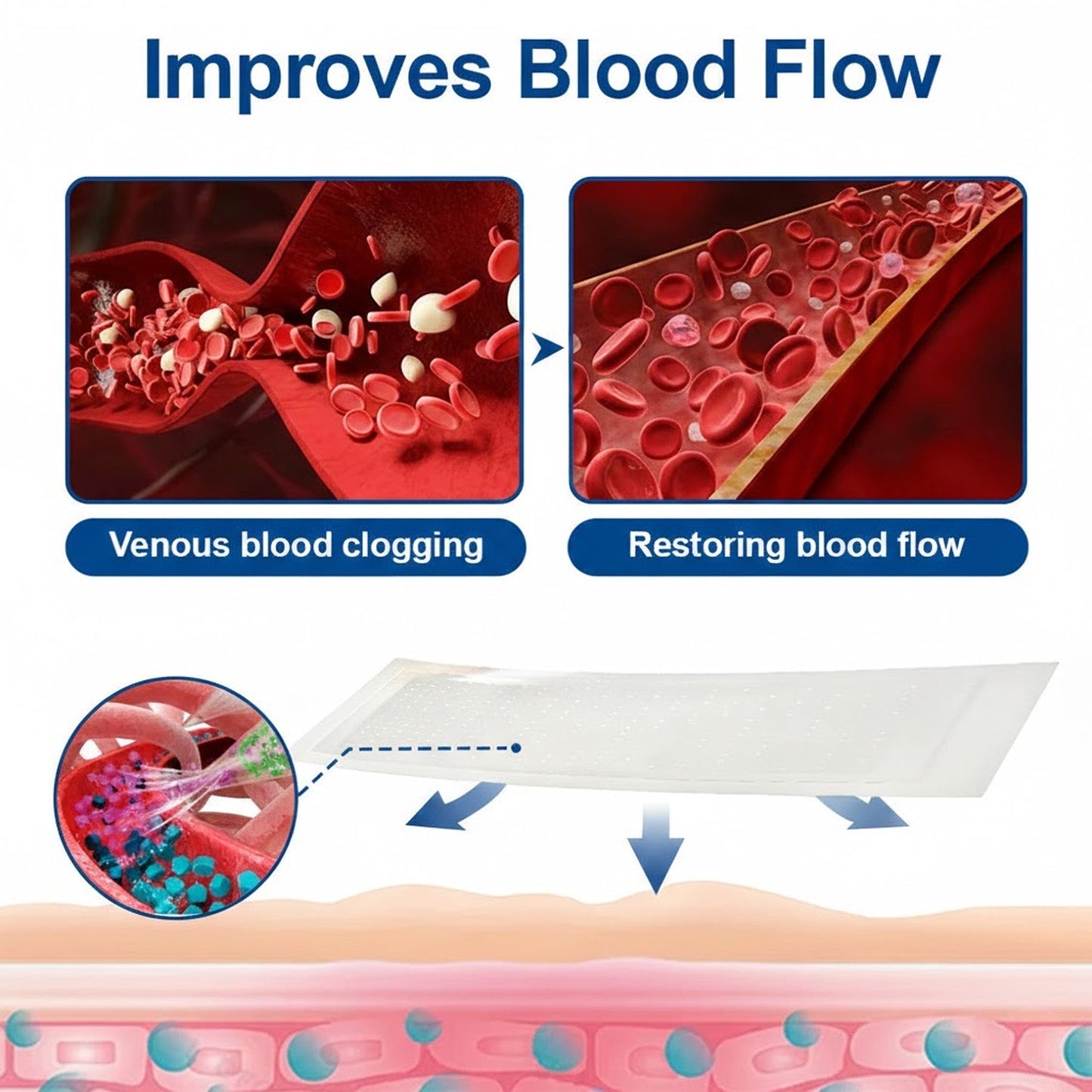 👨‍⚕️GFOUK® VeinEase Microneedle Care Patch⚡Instant Relief, Long-Term Results