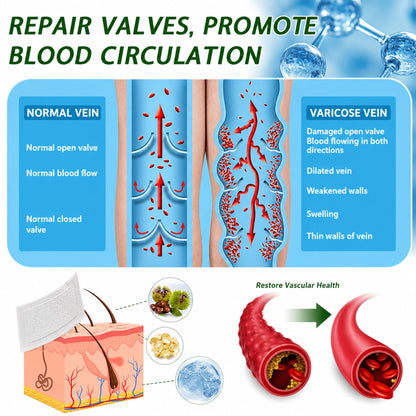 🌿DR.Fachmer® Vein Ease Microneedle Care Patch (For Spider Veins, Varicose Veins, Swelling & Leg Fatigue) - Last Day Promotion 50% OFF