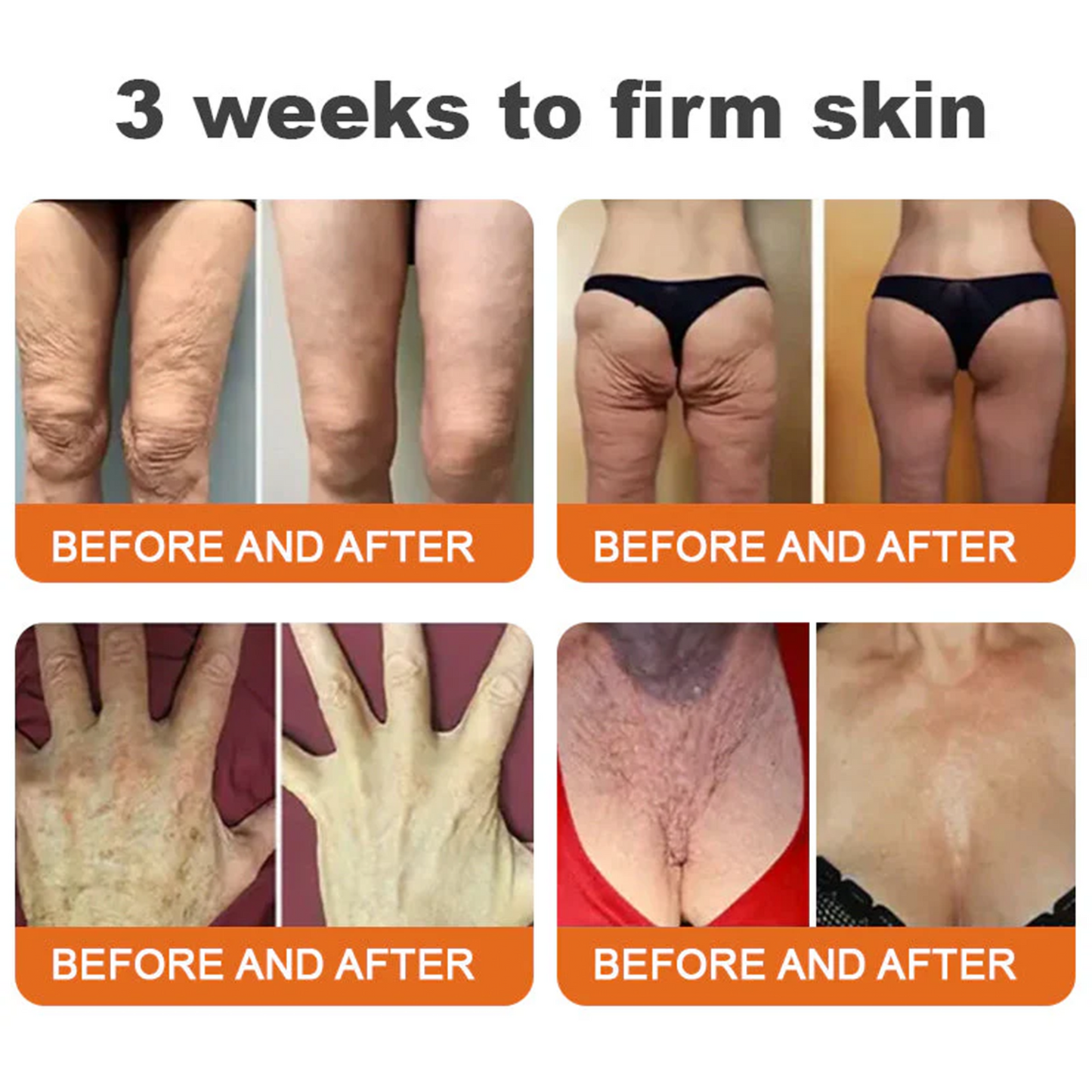 🌟💛 Rolimey® Bee venom Pro Comprehensive Cream —Tightening for Skin Types 🔥