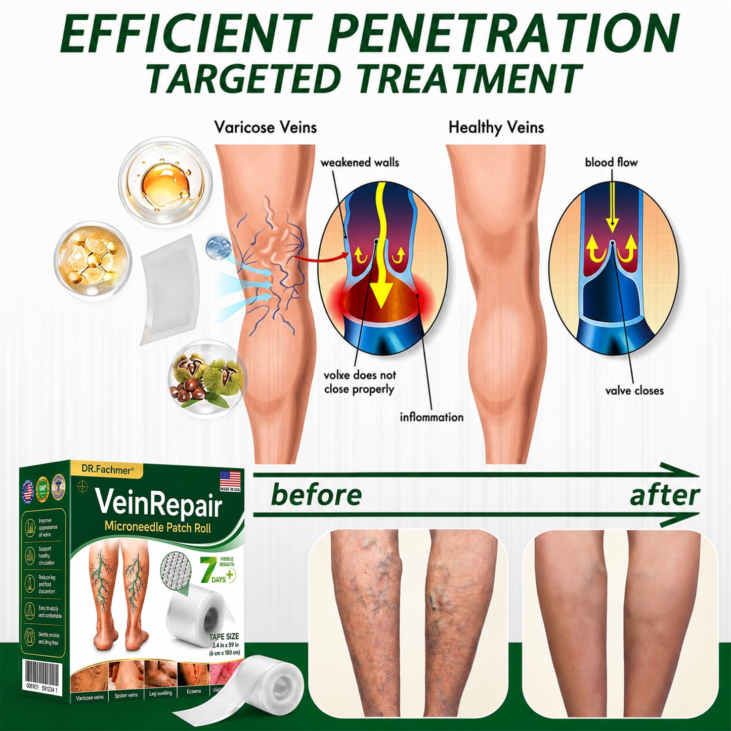 🌿DR.Fachmer® Vein Ease Microneedle Care Patch (For Spider Veins, Varicose Veins, Swelling & Leg Fatigue) - Last Day Promotion 50% OFF