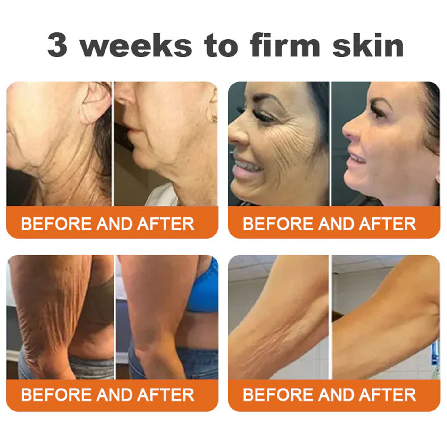 🌟💛 Rolimey® Bee venom Pro Comprehensive Cream —Tightening for Skin Types 🔥