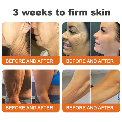 🌟💛 Rolimey® Bee venom Pro Comprehensive Cream —Tightening for Skin Types 🔥