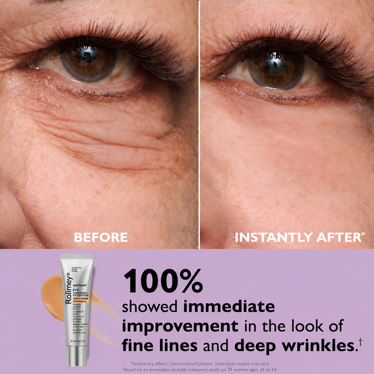 🎁Final 3 Hours: 70%OFF Instant Eye Tightener Easy-Wear Formula With Brush Free!